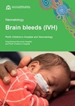 Cover image of the publication 'Brain bleeds (IVH): Quick guide' for King Edward Memorial Hospital and Perth Children's Hospital, depicting a baby sleeping on a parent's chest