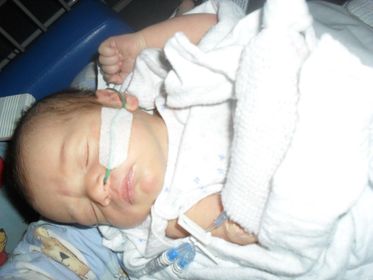 Baby Samantha in hospital with a feeding tube