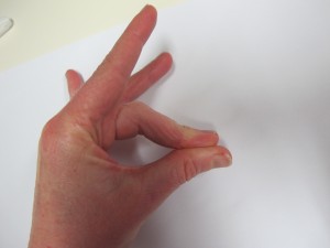 Patient holds the injured finger in hyperextension. 